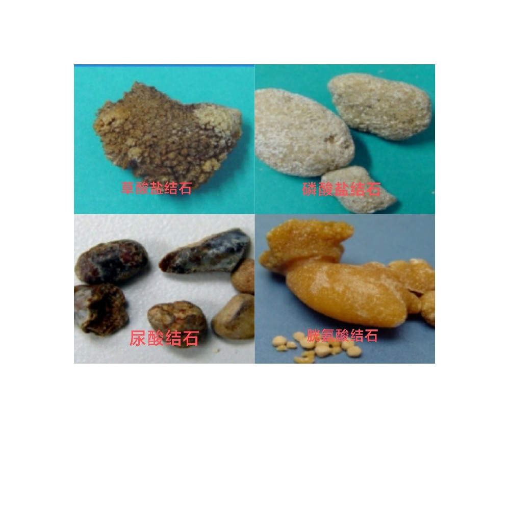 南通做微创保胆取石术的医院哪家好?